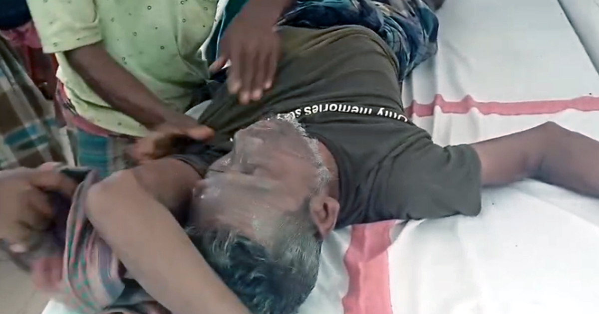 Youth electrocuted , seriously injured after fall of 11000 vault electric wire falls on house