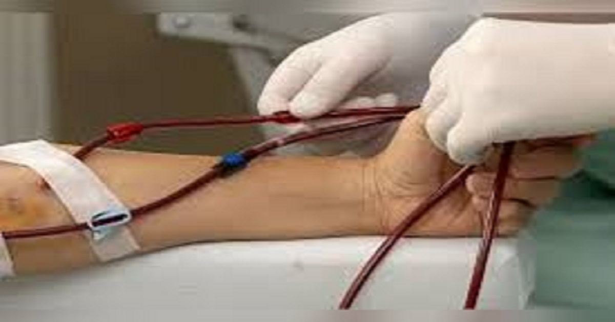 Five-day AV fistula surgical camp begins at GB Pant Hospital to aid dialysis patients